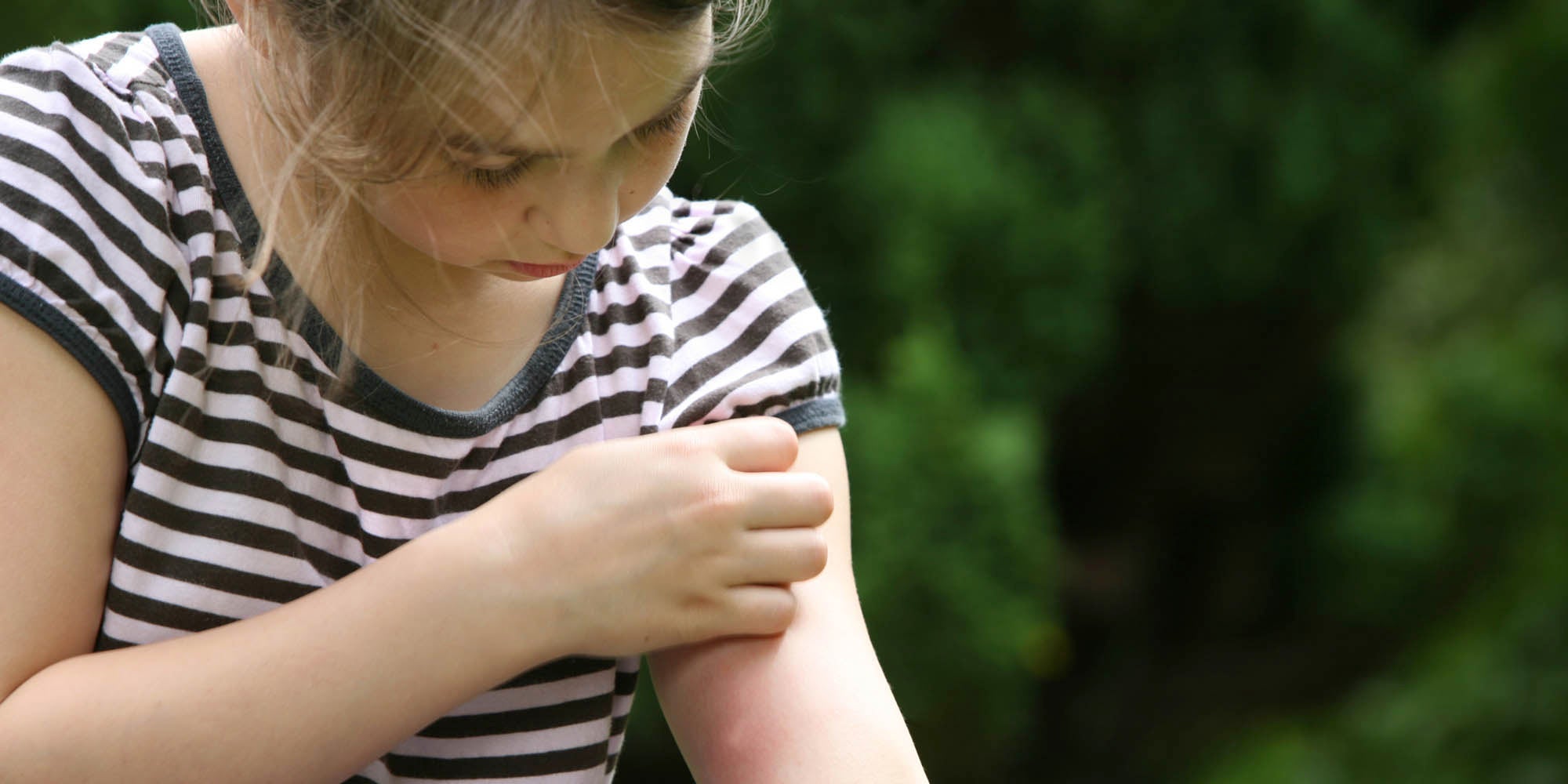 Child itching her arm from a bite