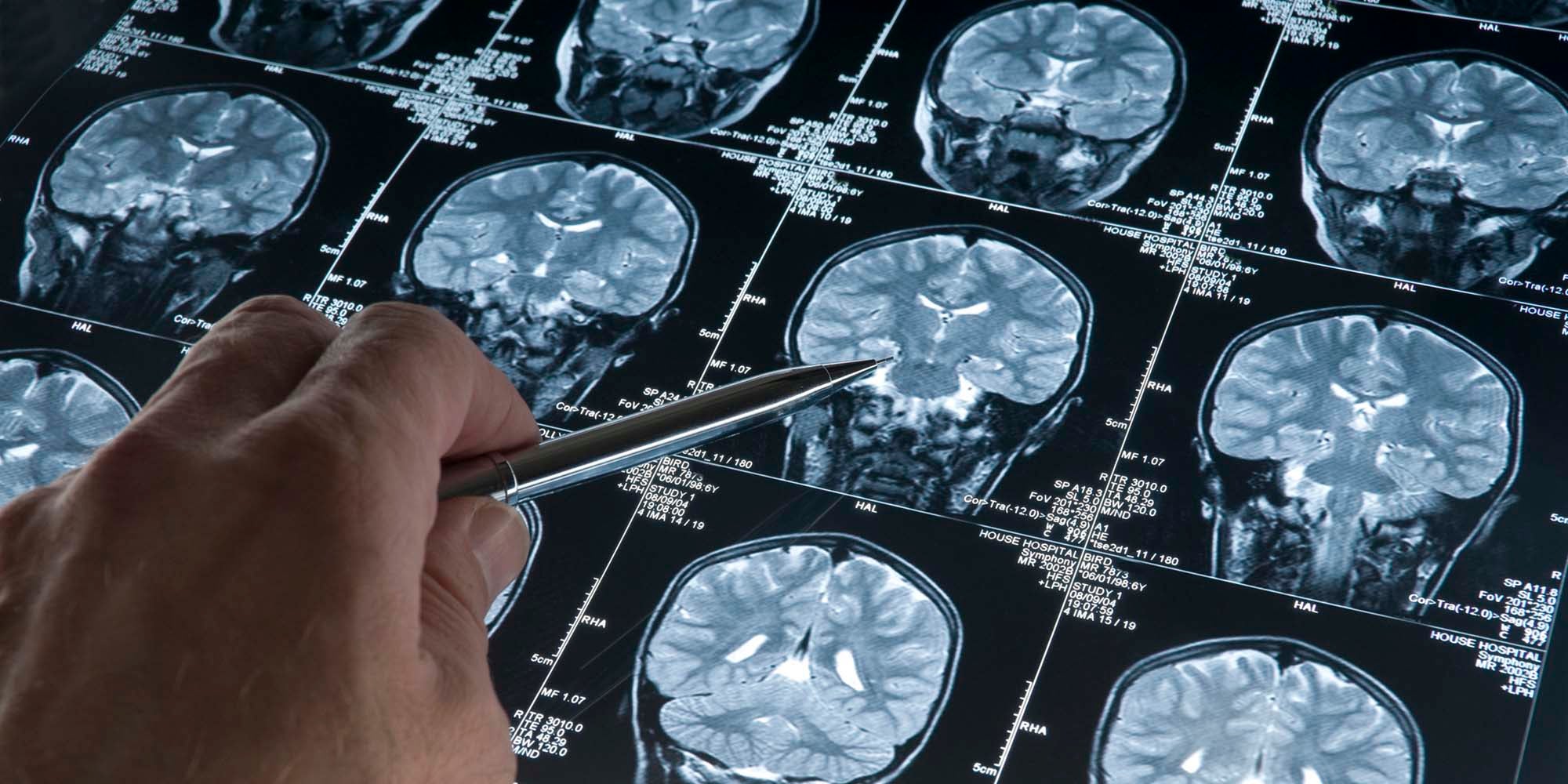 Center for Cranial Base Tumors Appointment