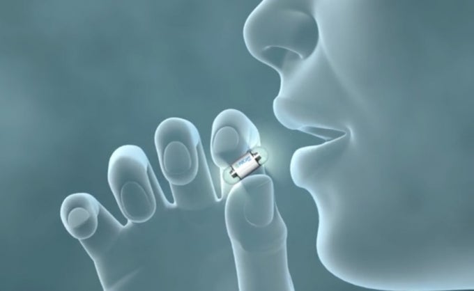 Loyola Medicine First in Chicago to Offer Pill Camera as Colonoscopy ...