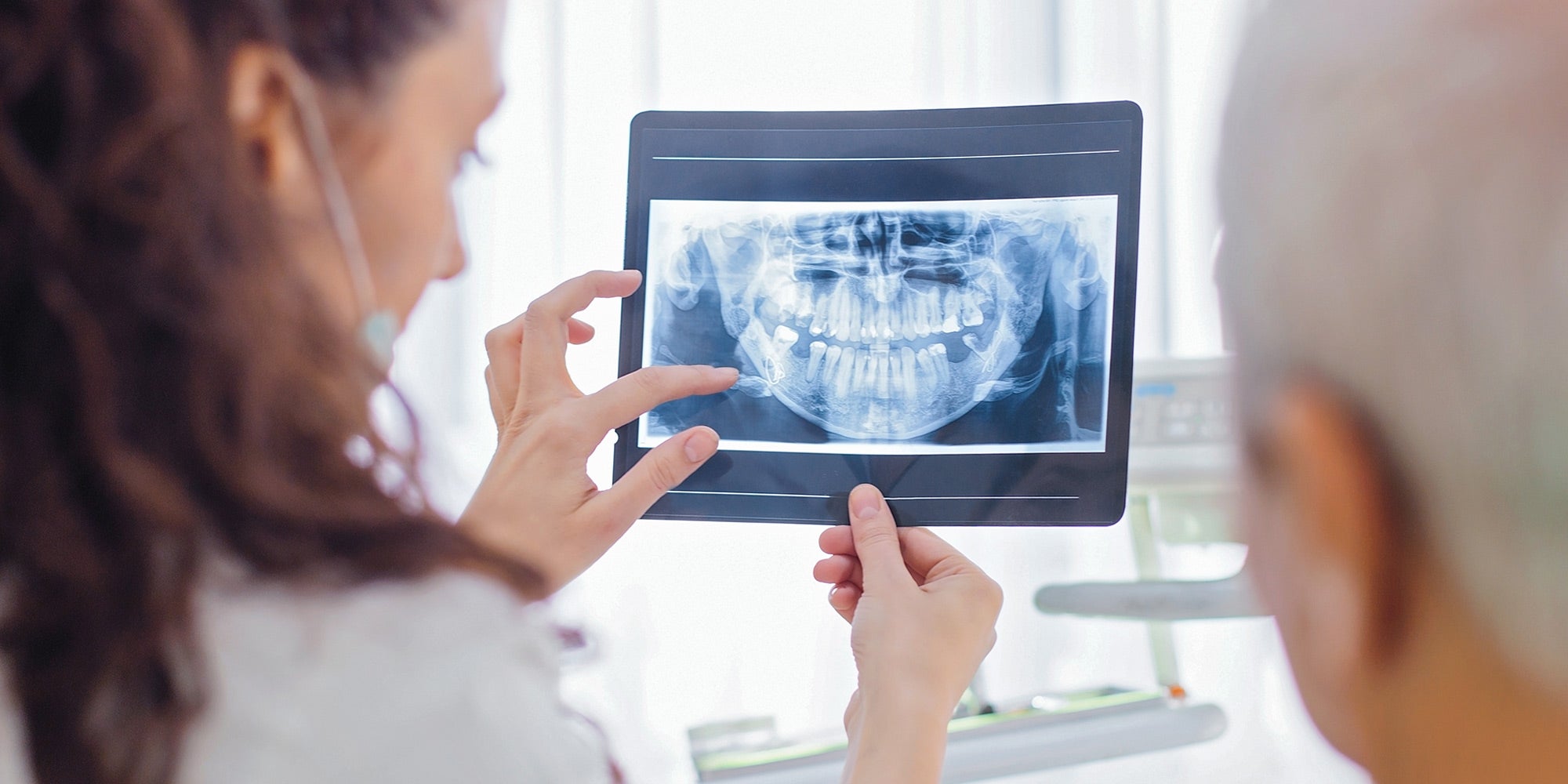 Doctor showing dental x-ray to patient