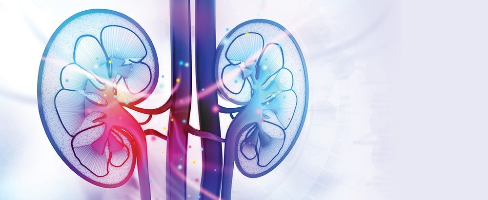 Kidney Transplant