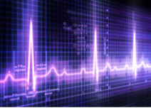 EKG image